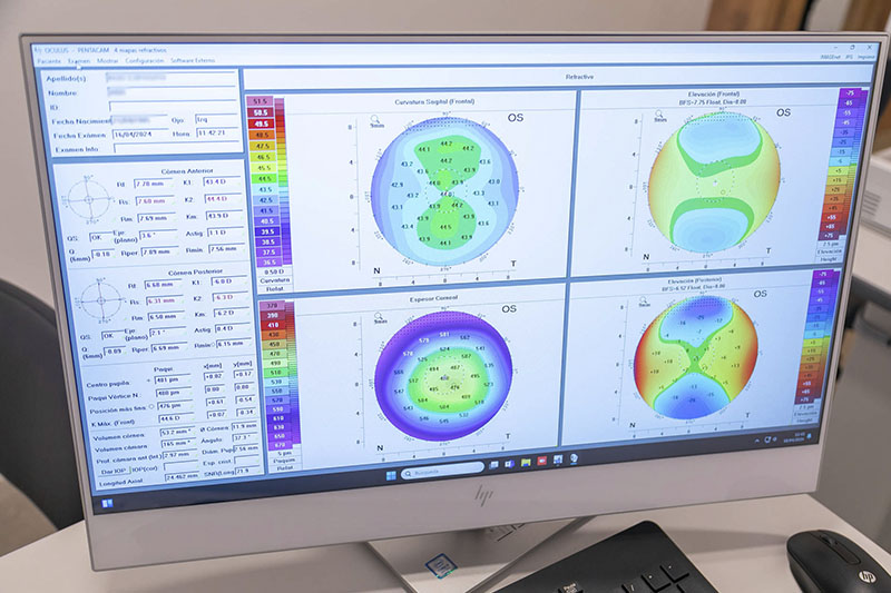 Clínica Olmo Oftalmología - Superficie Ocular tecnologia